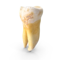 Broken Molar Lower Left Jaw PNG & PSD Images