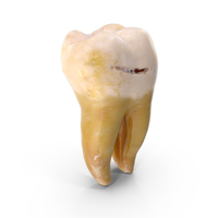 Molar Lower Jaw Left With Cavity PNG & PSD Images