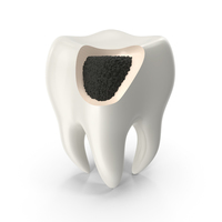 Caries damaged tooth PNG & PSD Images
