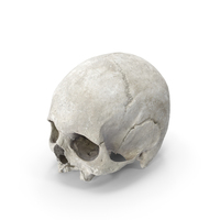 Human Skull Cranium with Leprosy PNG & PSD Images
