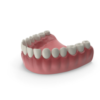 Lower Teeth Medical Model With Dental Implant PNG & PSD Images