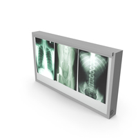 X-ray Lightbox PNG & PSD Images