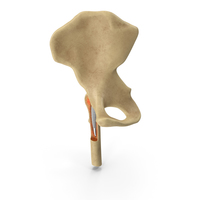 Hip Bone Replacement Surgery PNG & PSD Images