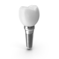 Tooth Dental Implant PNG & PSD Images