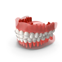 Typodont Tooth Retainer PNG & PSD Images