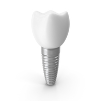 Implant Teeth PNG & PSD Images
