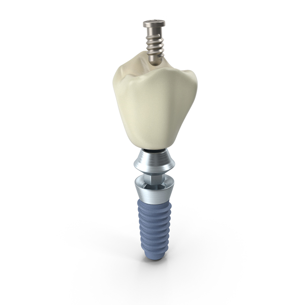 DENTAL IMPLANT PNG & PSD Images