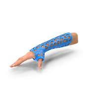 3D Printed Orthopedic Cast On Hand PNG & PSD Images