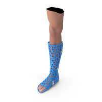 3D Printed Orthopedic Cast On Leg PNG & PSD Images
