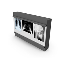 Negatoskop X-Ray Light Box PNG & PSD Images