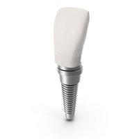 Tooth Implant PNG & PSD Images
