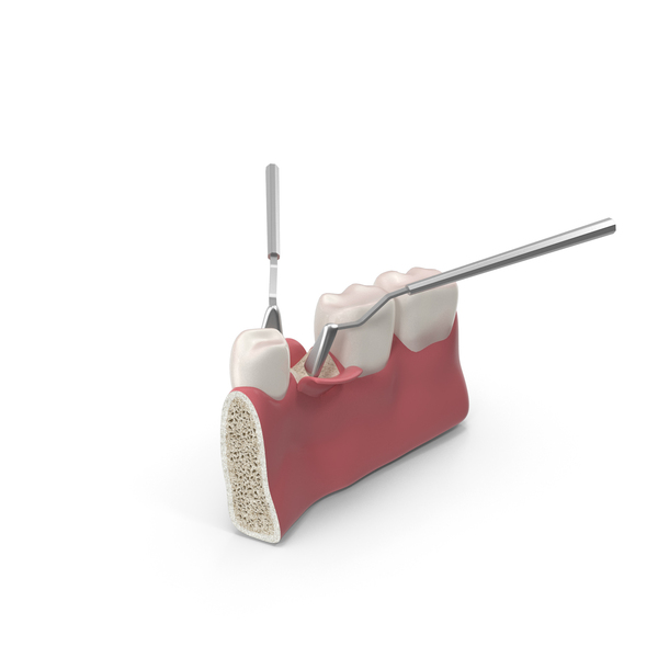 Dental Operation PNG & PSD Images