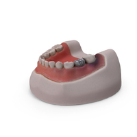 Teeth - Harvard Dental Typodont Model Scan PNG & PSD Images