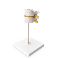Stand With Herniated Spinal Vertebrae PNG & PSD Images