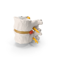 Part Of Spinal Column With Hernia PNG & PSD Images