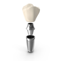Dental Implant PNG & PSD Images