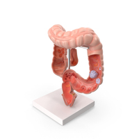 Medical Model Diseased Intestine PNG & PSD Images