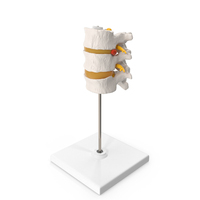 Herniated Vertebrae on Medical Stand PNG & PSD Images