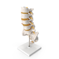 Spinal Column with Hernia on Stand PNG & PSD Images