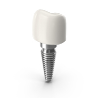 Tooth Implant PNG & PSD Images