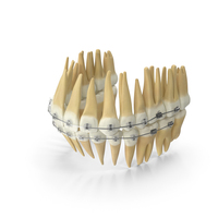 Dentition With Self Ligating Transparent Dental Braces PNG & PSD Images