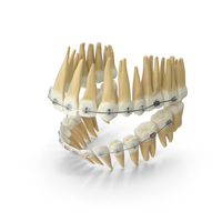 Dentition With Self Ligating Transparent Dental Braces PNG & PSD Images