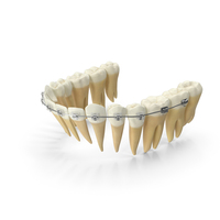 Lower Jaw Dentition With Self Ligating Transparent Dental Braces PNG & PSD Images