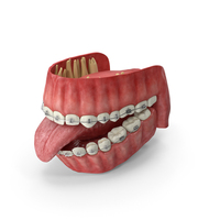 Human Mouth With Self Ligating Transparent Dental Braces PNG & PSD Images