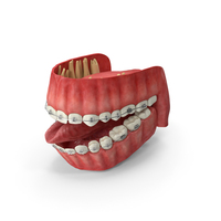 Human Mouth With Self Ligating Transparent Dental Braces PNG & PSD Images