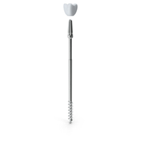 Zygomatic Dental Implants PNG & PSD Images