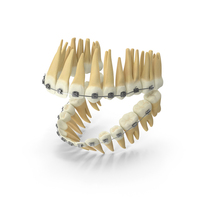 Dentition With Self Ligating Steel Dental Braces PNG & PSD Images