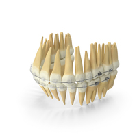 Dentition With Self Ligating Transparent Dental Braces PNG & PSD Images