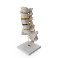 Intervertebral Disc Implant Installed on Spine PNG & PSD Images