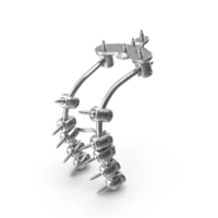 Posterior Cervical Spine Fixation System PNG & PSD Images