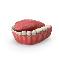 Human Lower Jaw With Self Ligating Transparent Dental Braces PNG & PSD Images