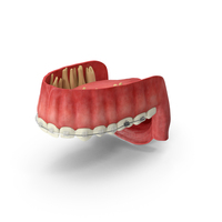 Human Upper Jaw With Self Ligating Transparent Dental Braces PNG & PSD Images