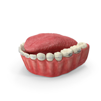 Human Lower Jaw With Self Ligating Transparent Dental Braces PNG & PSD Images
