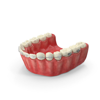 Human Lower Jaw With Self Ligating Transparent Dental Braces PNG & PSD Images