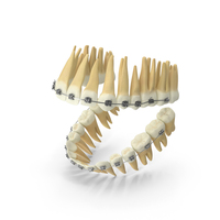 Dentition With Self Ligating Steel Dental Braces PNG & PSD Images