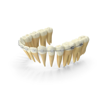 Lower Jaw Dentition With Self Ligating Transparent Dental Braces PNG & PSD Images