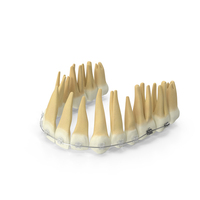 Upper Jaw Dentition With Self Ligating Transparent Dental Braces PNG & PSD Images
