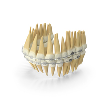 Dentition With Transparent Dental Braces PNG & PSD Images