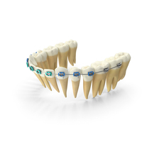 Lower Jaw Dentition With Steel Dental Braces PNG & PSD Images