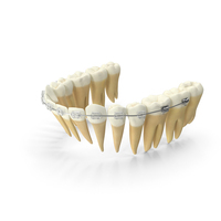 Lower Jaw Dentition With Transparent Dental Braces PNG & PSD Images