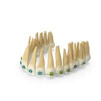 Upper Jaw Dentition With Steel Dental Braces PNG & PSD Images