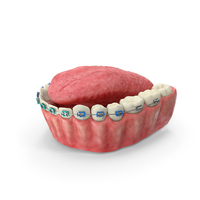 Human Lower Jaw And Tongue With Steel Dental Braces PNG & PSD Images