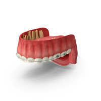 Human Upper Jaw With Transparent Dental Braces PNG & PSD Images