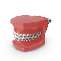 Ligature Braces on Teeth Model PNG & PSD Images