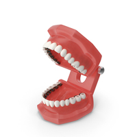 Lingual Braces On Typodont Teeth Model PNG & PSD Images