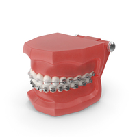 Ligature-Free Braces On Artificial Jaw PNG & PSD Images